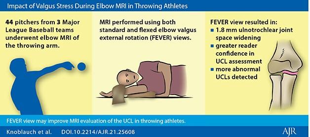 Impact of Valgus Stress During Elbow MRI in Throwing Athletes
