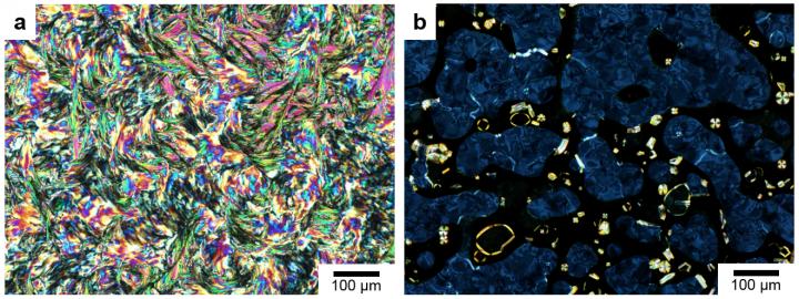 Polarized Optical Microscopy Images