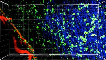 Vignali Lab 3-D Microscopic Image of Tumor