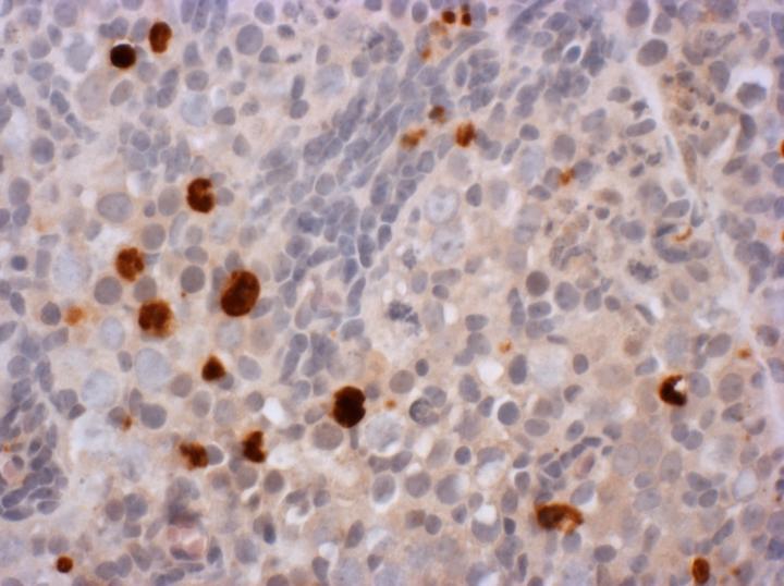 Ovarian Tissue that Has Been Exposed to Ibuprofen for Seven Days