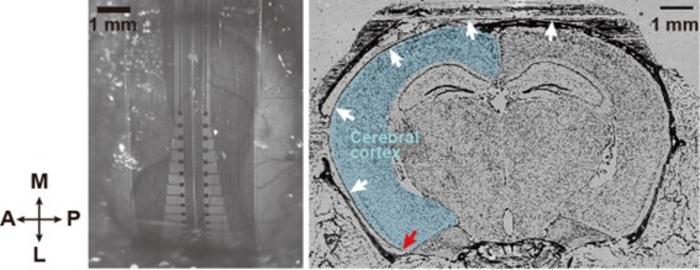 Placement of the developed electrocorticography device on the mouse brain surface