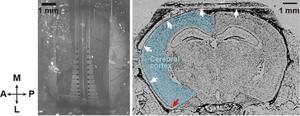 Placement of the developed electrocorticography device on the mouse brain surface