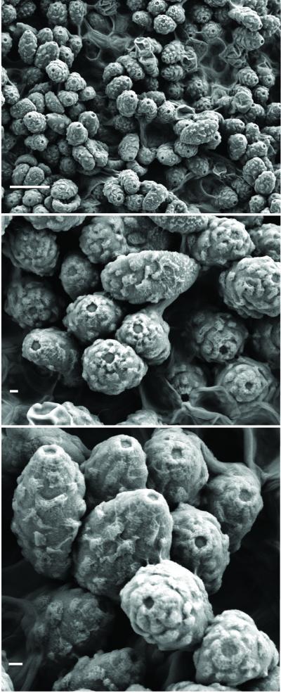 <i>Spongiforma squarepantsii</i> Spores