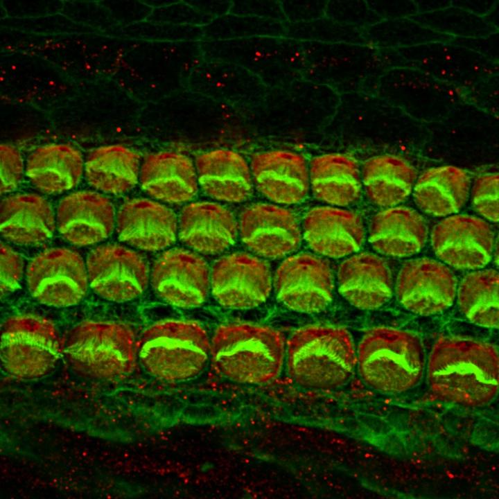 Hair Cells for Hearing