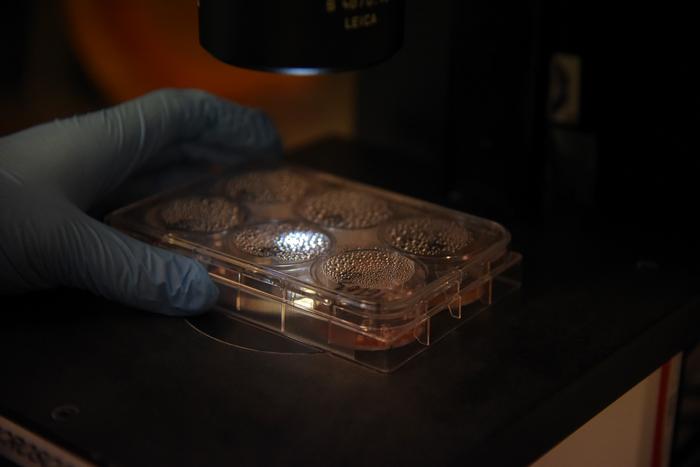 Mini-brains in the microscope