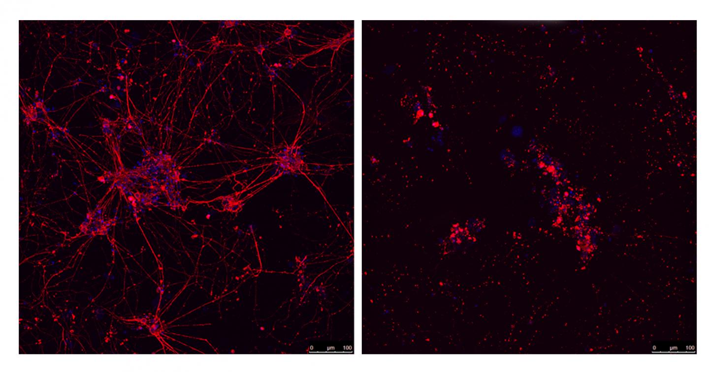 Mouse motor neurons, CNIO