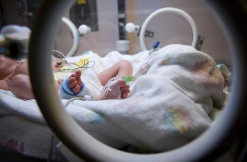 Dartmouth TDI NICU Study