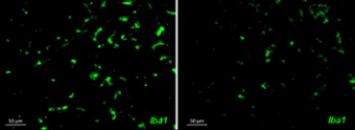 Inflammatory microglia