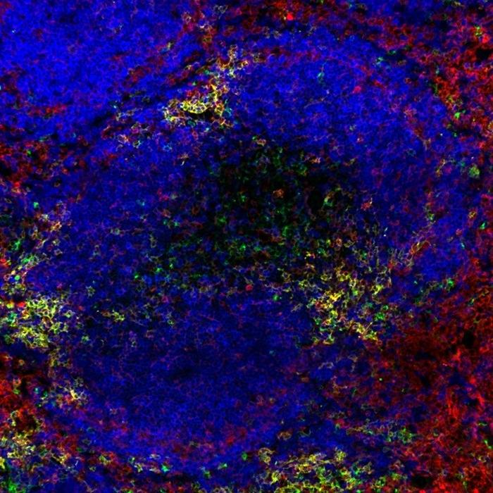 Image of a murine white pulp of the spleen, in which large amounts of B cells (B220, blue) and dendritic cells (CD11c, green) can be found. The red pulp is highlighted by myeloid cell staining (SIRPα, red).