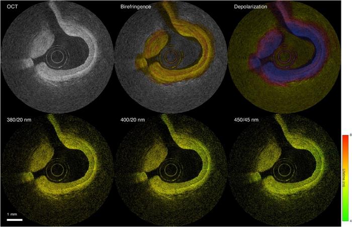 FLIM-PSOCT images