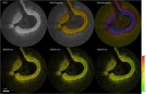 FLIM-PSOCT images