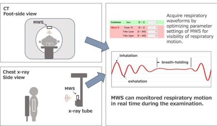 Real-time respiratory motion monitoring with millimeter-wave sensor