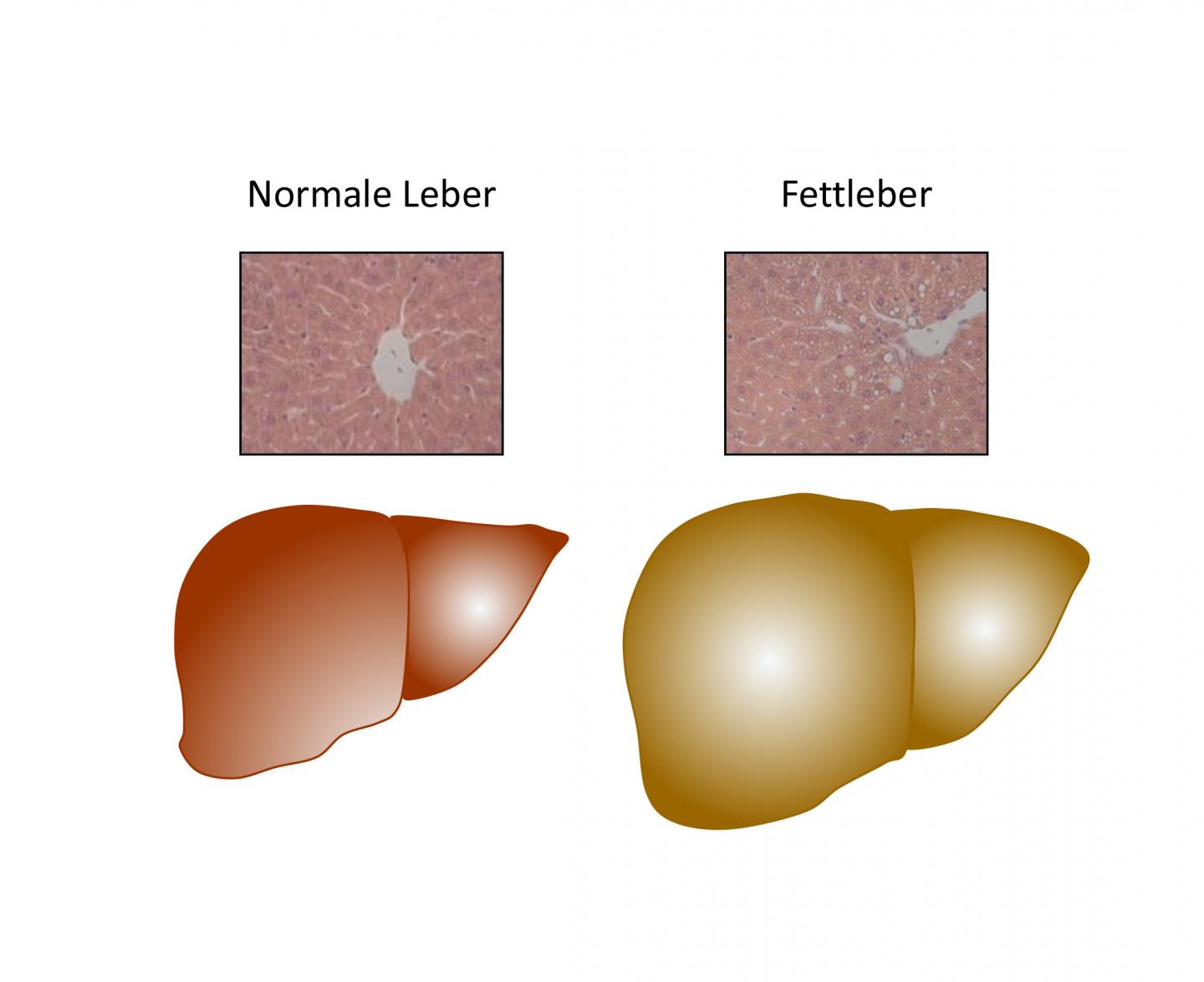 Liver