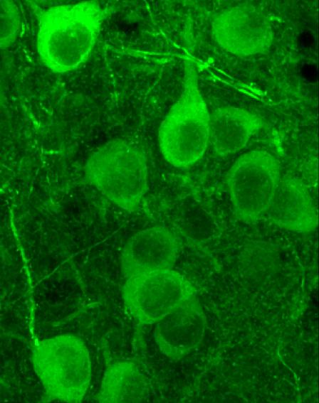 Deep Brain Imaging of Basal Amygdala Neurons in Freely Moving Mice (2 of 2)