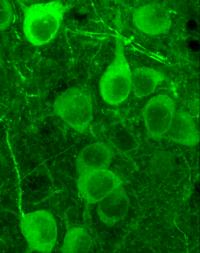 Deep Brain Imaging of Basal Amygdala Neurons in Freely Moving Mice (2 of 2)