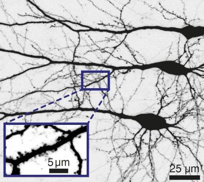Nerve Cells Form Networks that Can Process Signals