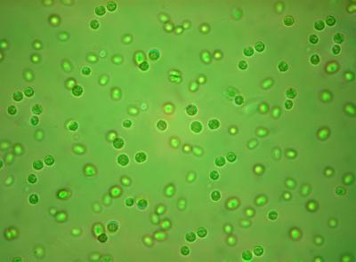 Tomorrow’s Energy Suppliers: Microalgae under the Microscope