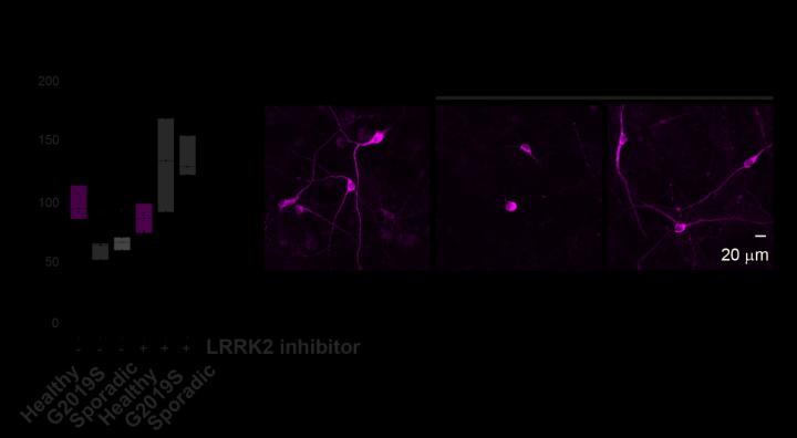 Parkinson's Research Images