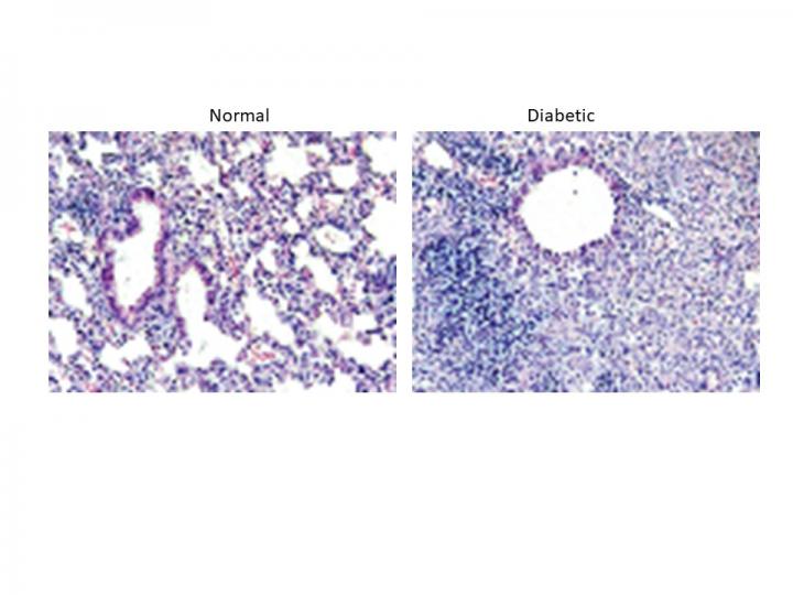 Inflammation in Lungs of Diabetic Mouse Vs. Control