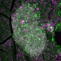 Blocking Nerve Signals to the Pancreas Halts Type 1 Diabetes Onset in Mice