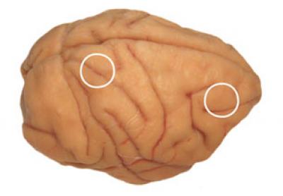 Hubs of Brain Working Memory Circuit