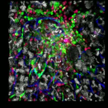 Immune Cells Swarming a Islet in a Mouse Pancreas