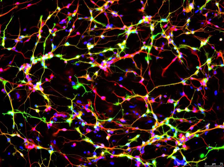 Dopamine Neurons Converted Directly from Fibroblasts