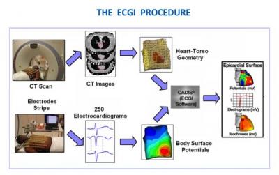 ECGI Imaging