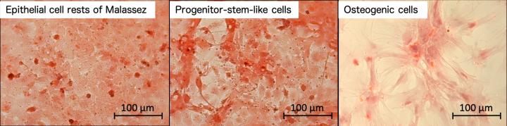 Figure 3. Analysis of calcification in the progenitor-stem-like cells that were differentiated into osteogenic cells.