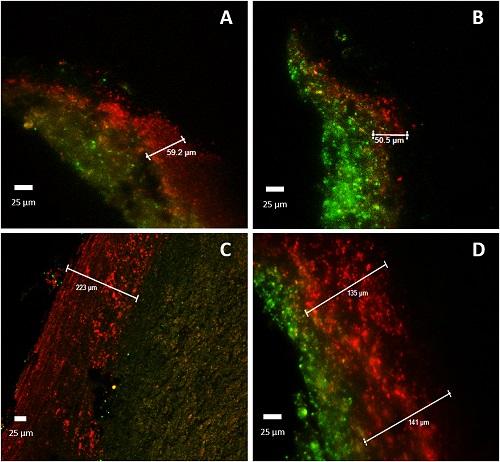 Micrographs of Differentially Stained Sclerotia Cross-Sections