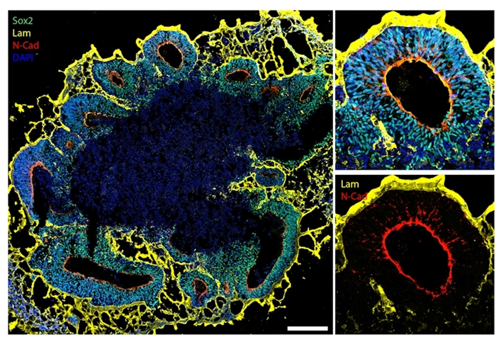 Brain organoids in detail.