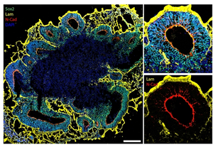 Brain organoids in detail.