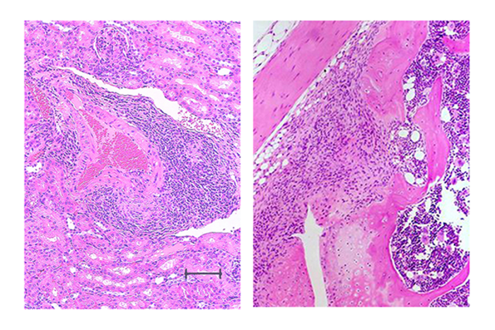 New Spontaneous Mouse Model Sh [image] Eurekalert Science News Releases