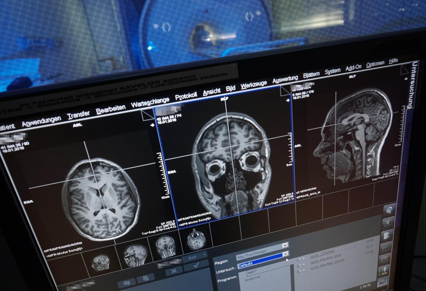 Magnetic Resonance Imaging of the Human Brain