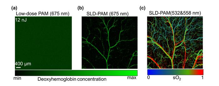 Image comparison of the in vivo results of Low-dose PAM and SLD-PAM