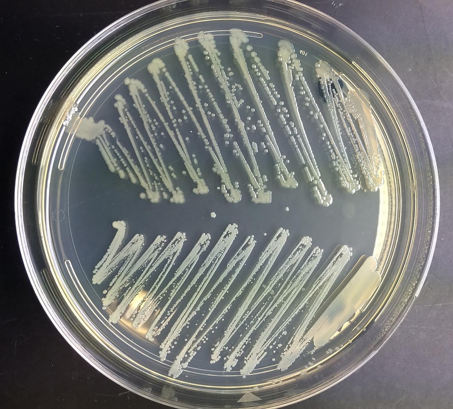 Environment, Not Genes, Explains <i>Staphylococcus aureus</i> in the Nose