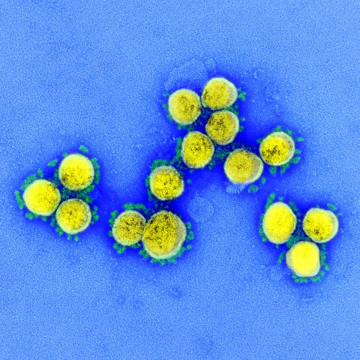 SARS-CoV-2 Particles