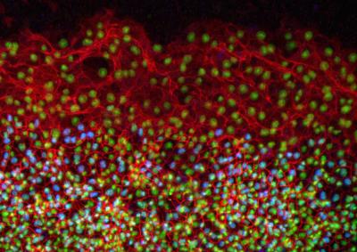 BrDU Proliferating Cells
