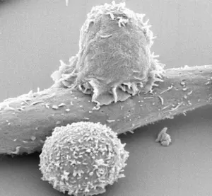 A T cell killing a cancer cell