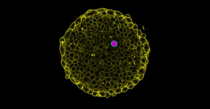 Osmotic Pressure