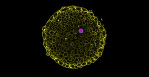 Osmotic Pressure