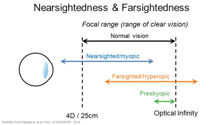 Nearsightedness and Farsightedness