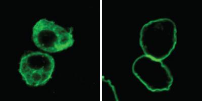 Merlin Relocates Warts