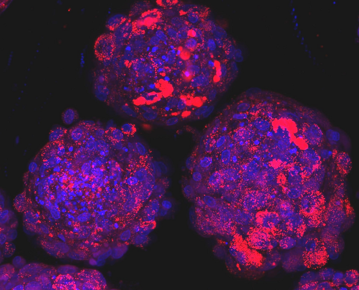 Human mesenchymal stem cells were differentiated into fat cells and the fat vacuoles were stained:  stem cells and their differentiation products contain specific fatty sweet surface structures (glycolipids) that help distinguish them from each other.