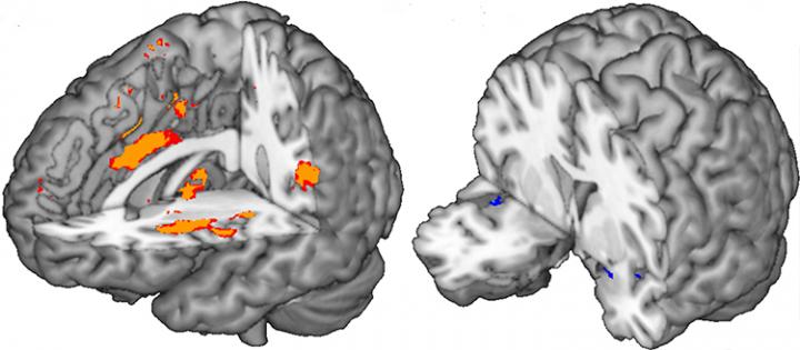 Biomarqueurs cÃ©rÃ©braux