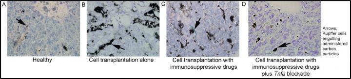 Example of inflammation in liver after cells are transplanted with or without neutralizing tumor necrosis factor (TNF)