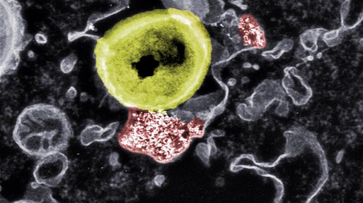 Fighting harmful bacteria with nanoparticles