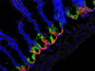 Rare Group of Cells Could Inform Development of Therapies for Inflammatory Bowel Disease