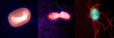 'Superhero' Microbiome Bacteria Protect against Deadly Symptoms during Infection