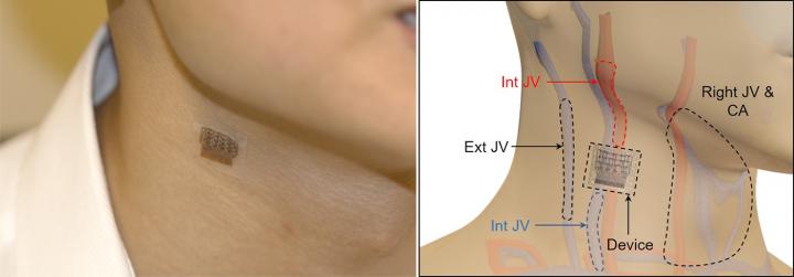 Wearable Ultrasound Patch on Neck